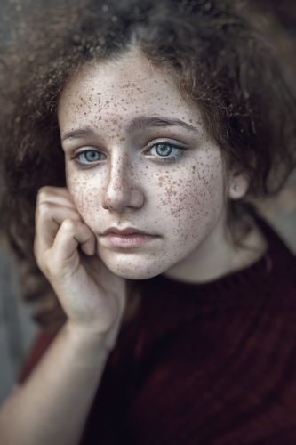 Freckles Beauty